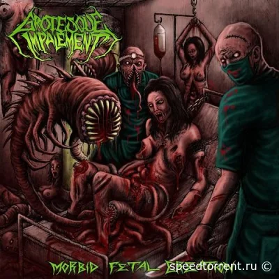 Grotesque Impalement - Morbid Fetal Creation (2021)